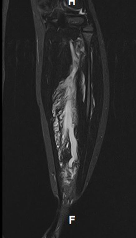 Risonanza Magnetica